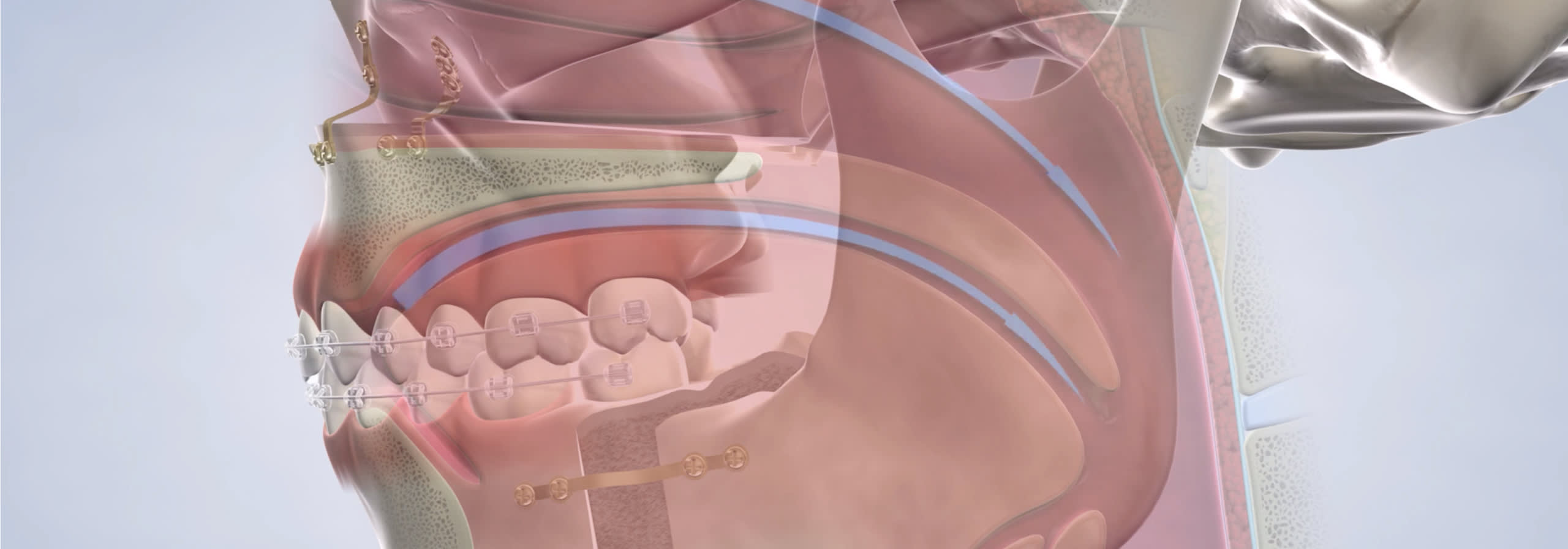 Sleep apnea procedure desktop